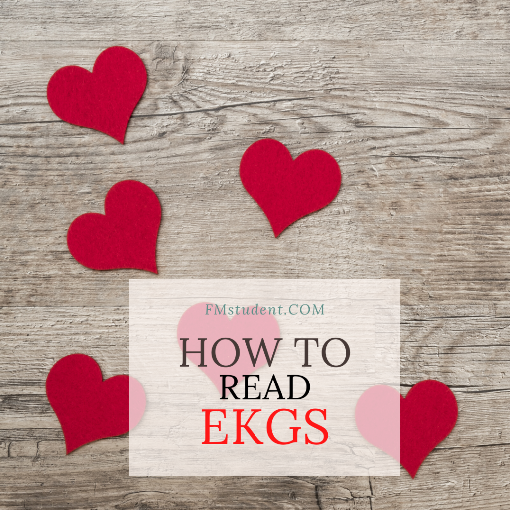 How to Read EKGs